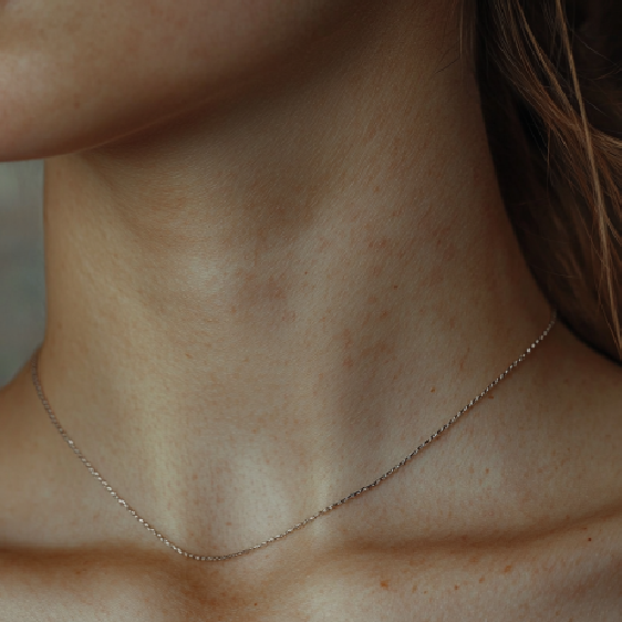 Krinky: Prečo sa stávajú a ako sa ich zbaviť